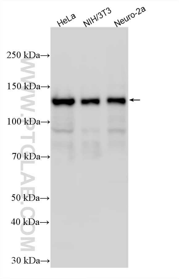 Western Blot (WB) analysis of various lysates using HDAC4-specific Polyclonal antibody (16165-1-AP)