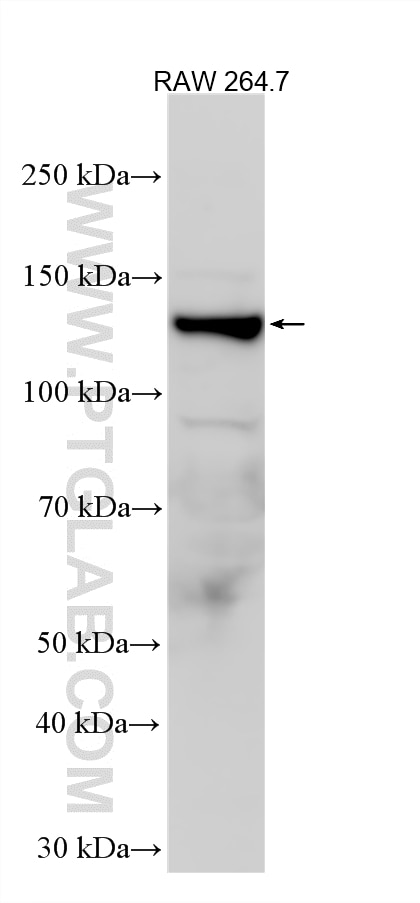 Western Blot (WB) analysis of various lysates using HDAC4-specific Polyclonal antibody (16165-1-AP)