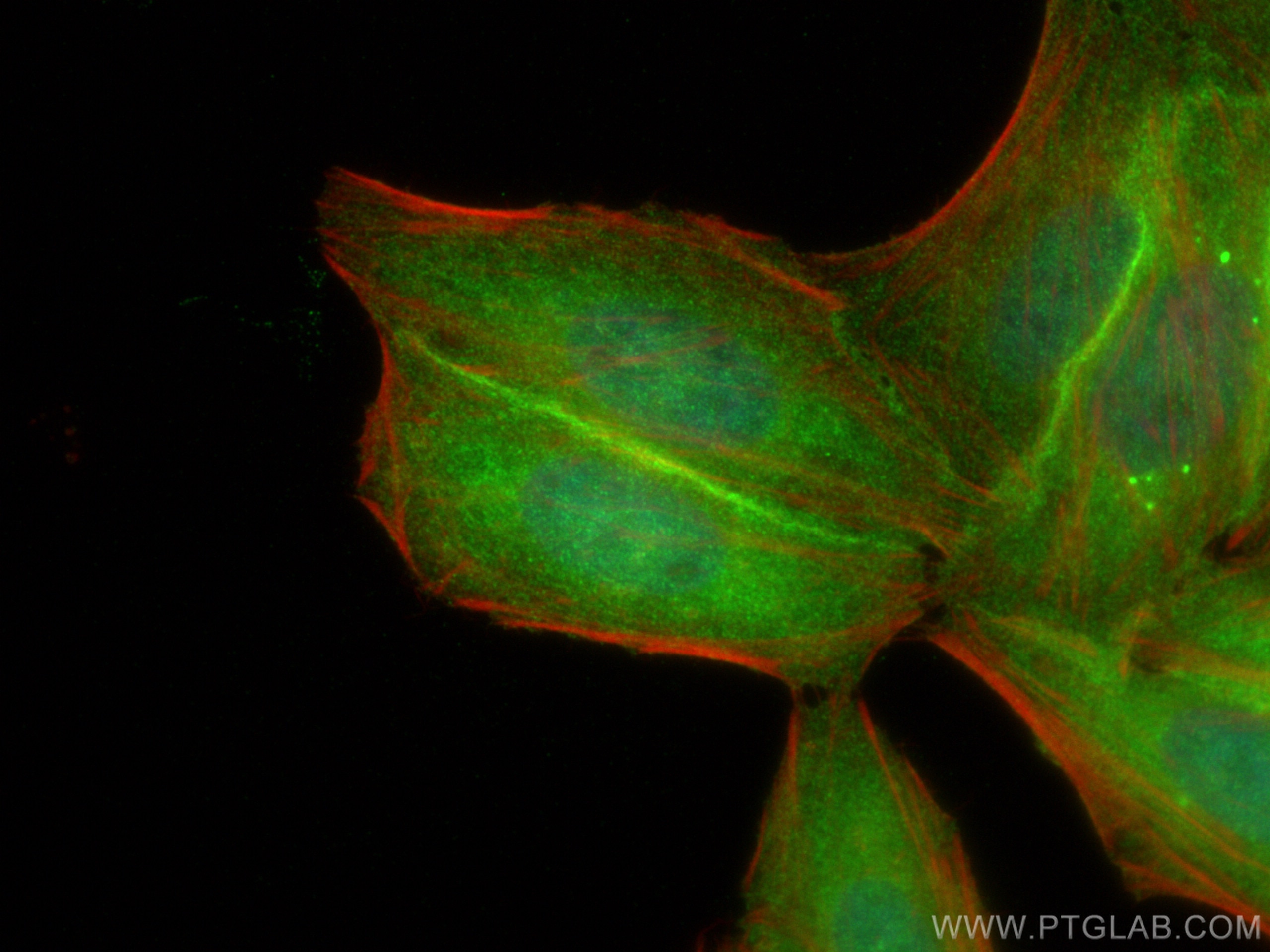 Immunofluorescence (IF) / fluorescent staining of HepG2 cells using HDAC5 Polyclonal antibody (29342-1-AP)