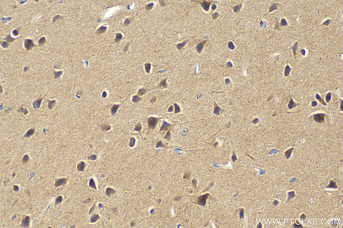 Immunohistochemistry (IHC) staining of mouse brain tissue using HDAC5 Polyclonal antibody (29342-1-AP)