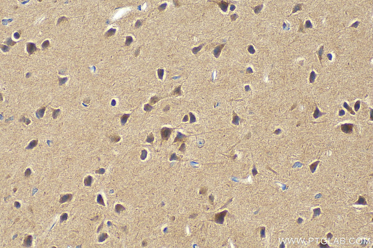 Immunohistochemistry (IHC) staining of mouse brain tissue using HDAC5 Polyclonal antibody (29342-1-AP)