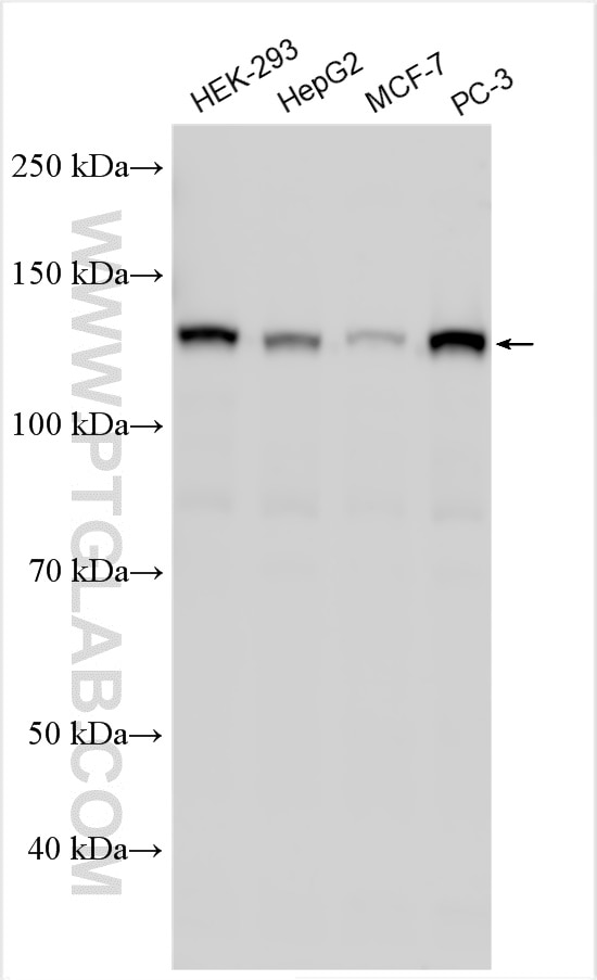 Western Blot (WB) analysis of various lysates using HDAC5 Polyclonal antibody (29342-1-AP)