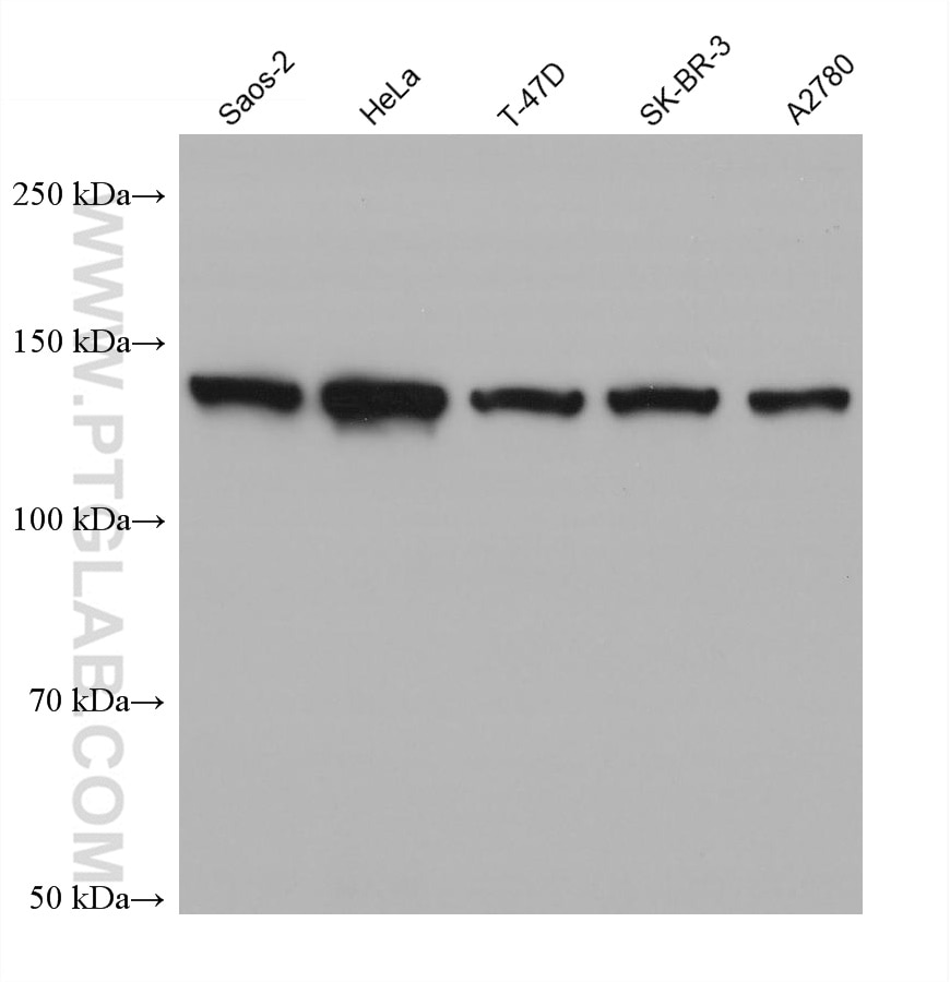 Western Blot (WB) analysis of various lysates using HDAC5 Monoclonal antibody (68437-1-Ig)