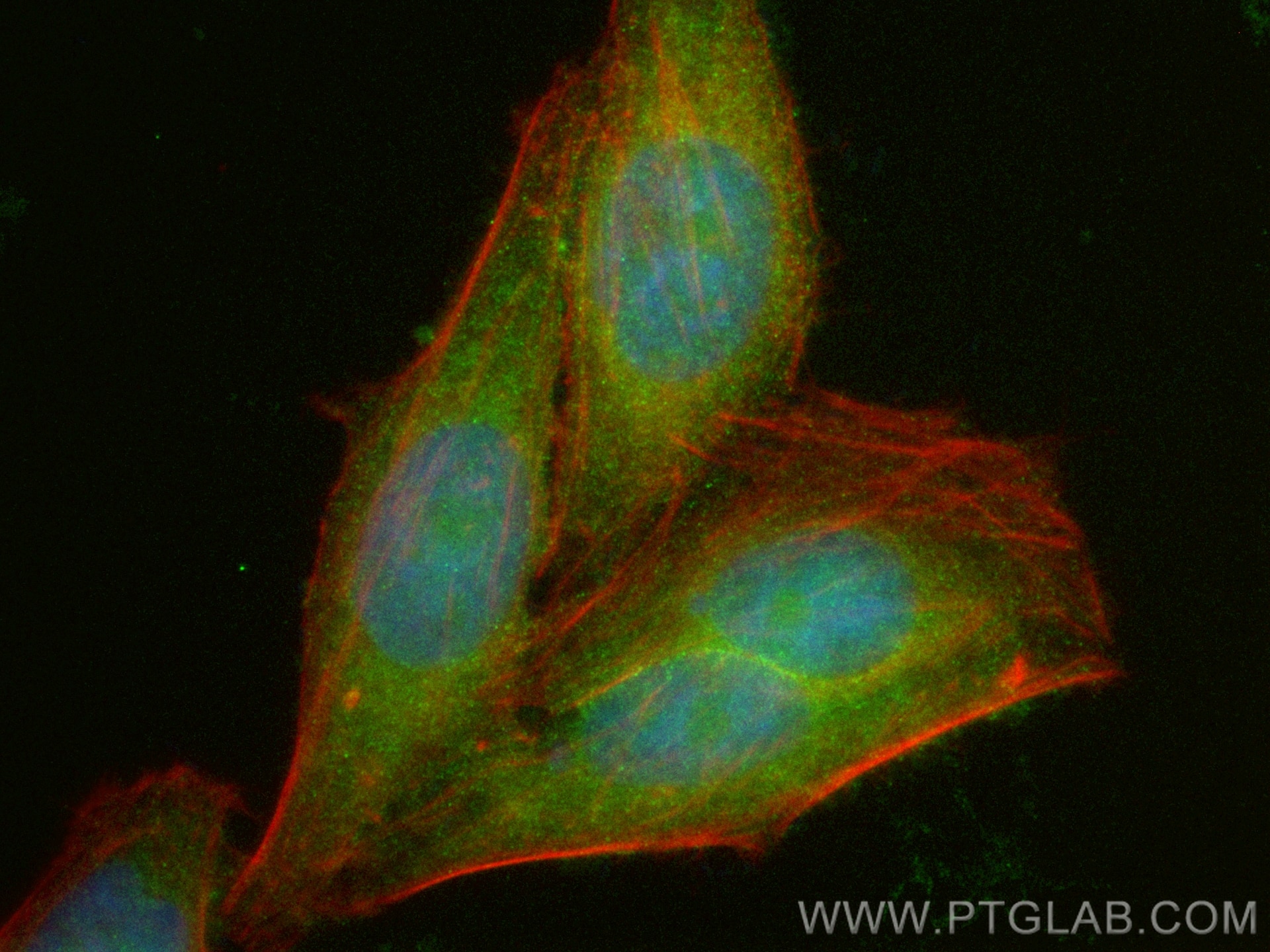 Immunofluorescence (IF) / fluorescent staining of HepG2 cells using CoraLite® Plus 488-conjugated HDAC5 Polyclonal ant (CL488-29342)