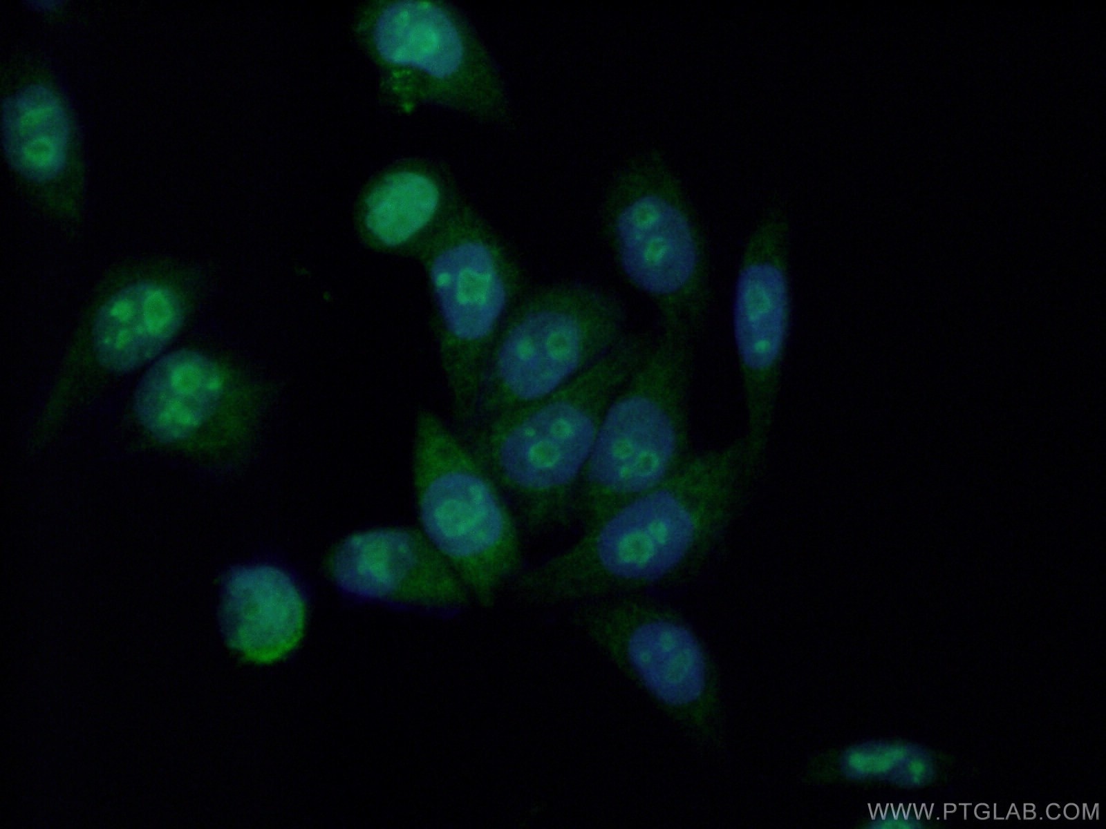 Immunofluorescence (IF) / fluorescent staining of HeLa cells using HDAC5-specific Polyclonal antibody (16166-1-AP)