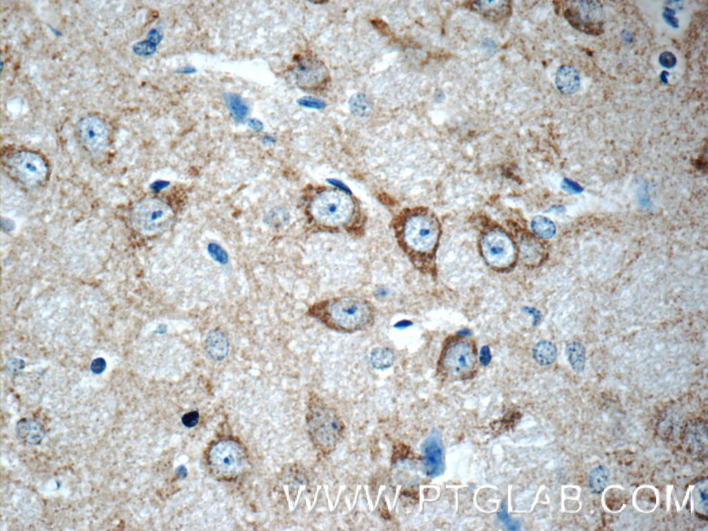 IHC staining of mouse brain using 16166-1-AP