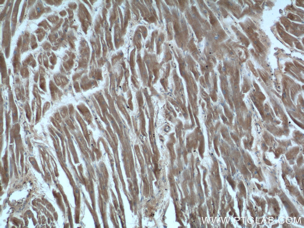 IHC staining of human heart using 16166-1-AP