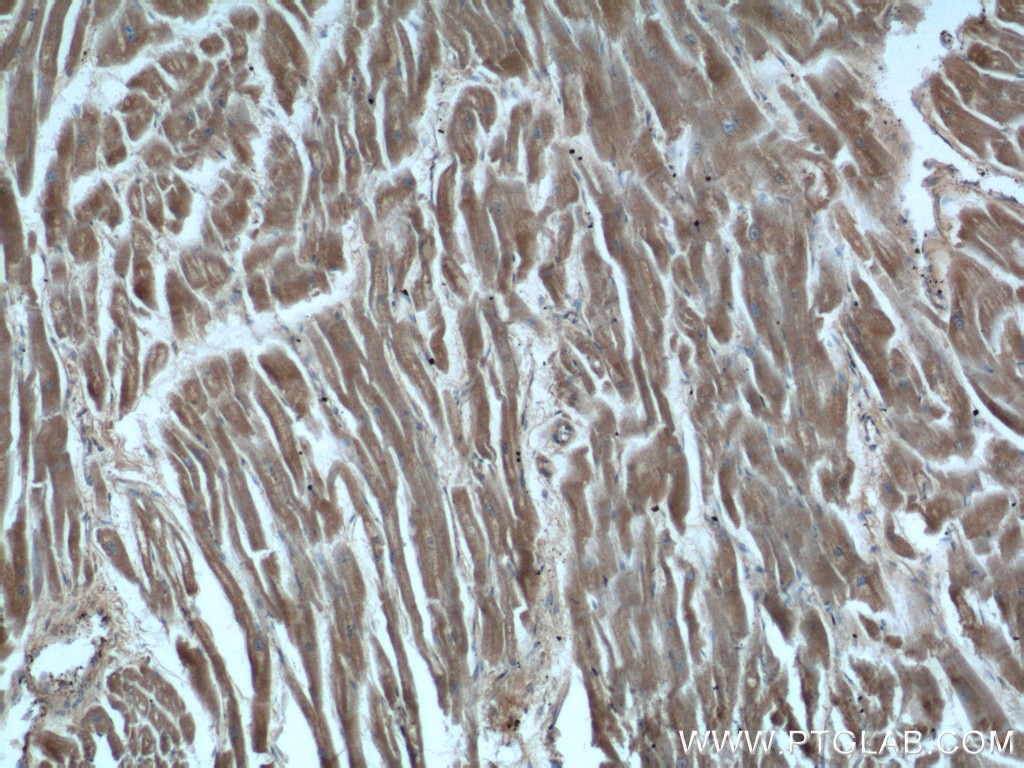 Immunohistochemistry (IHC) staining of human heart tissue using HDAC5-specific Polyclonal antibody (16166-1-AP)