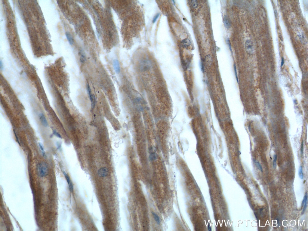 IHC staining of human heart using 16166-1-AP