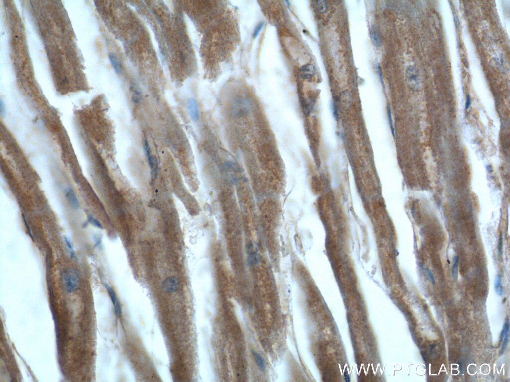 IHC staining of human heart using 16166-1-AP