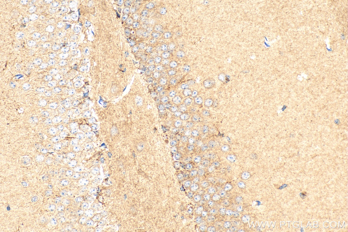 Immunohistochemistry (IHC) staining of mouse brain tissue using HDAC5-specific Polyclonal antibody (16166-1-AP)