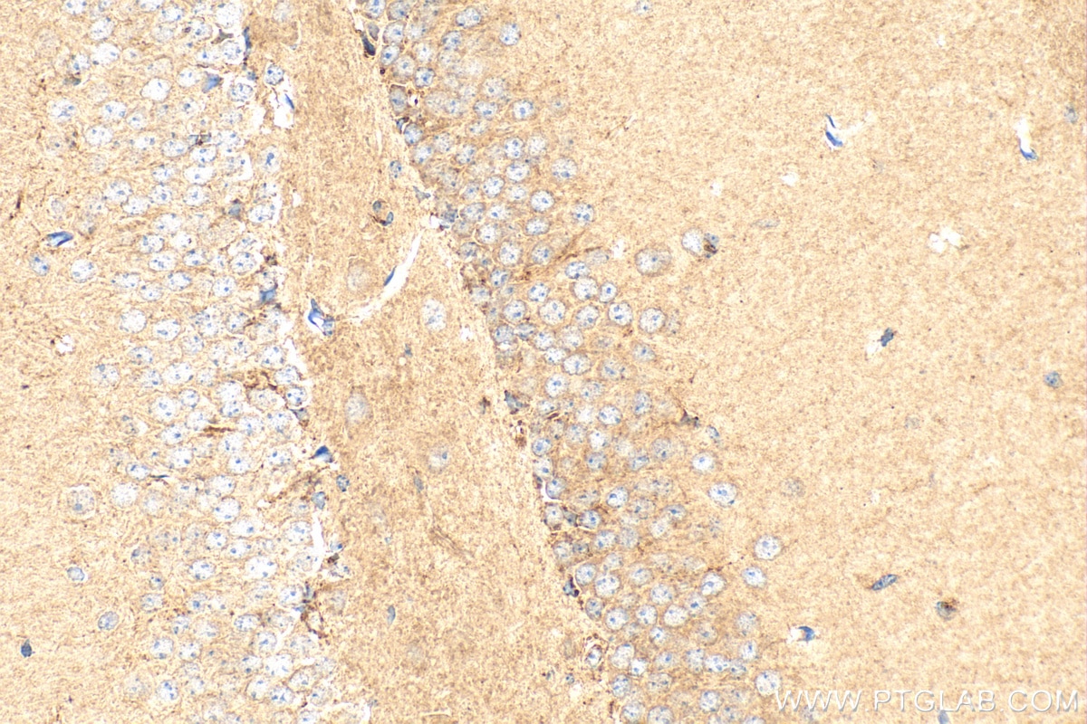 IHC staining of mouse brain using 16166-1-AP