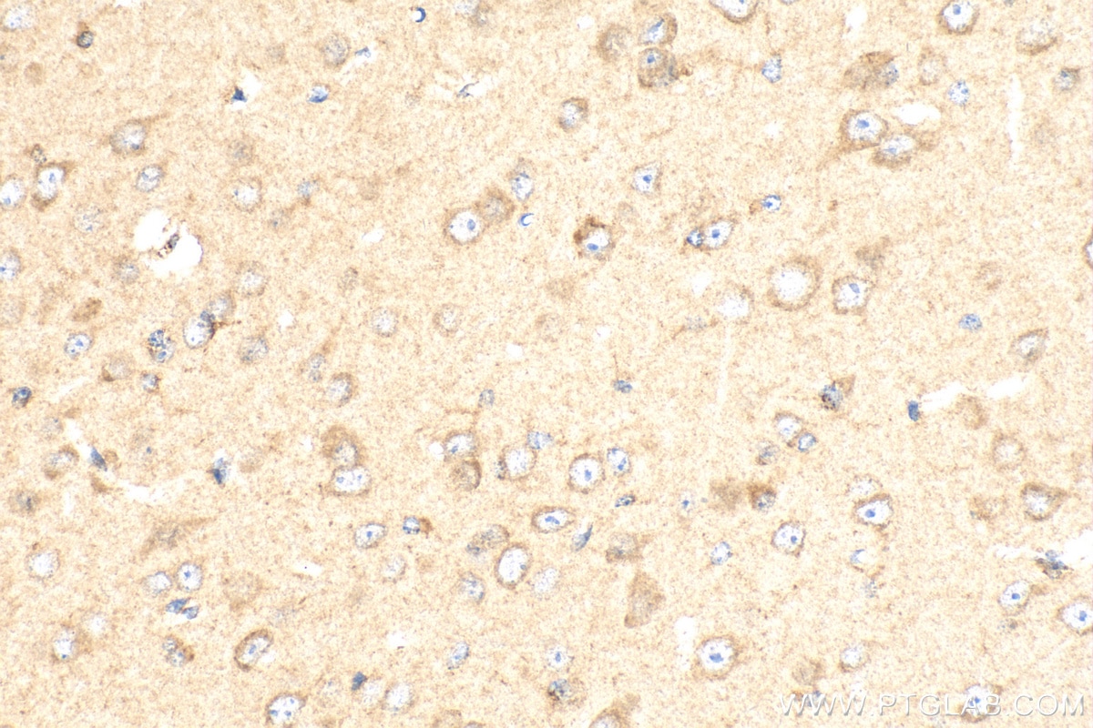 IHC staining of mouse brain using 16166-1-AP
