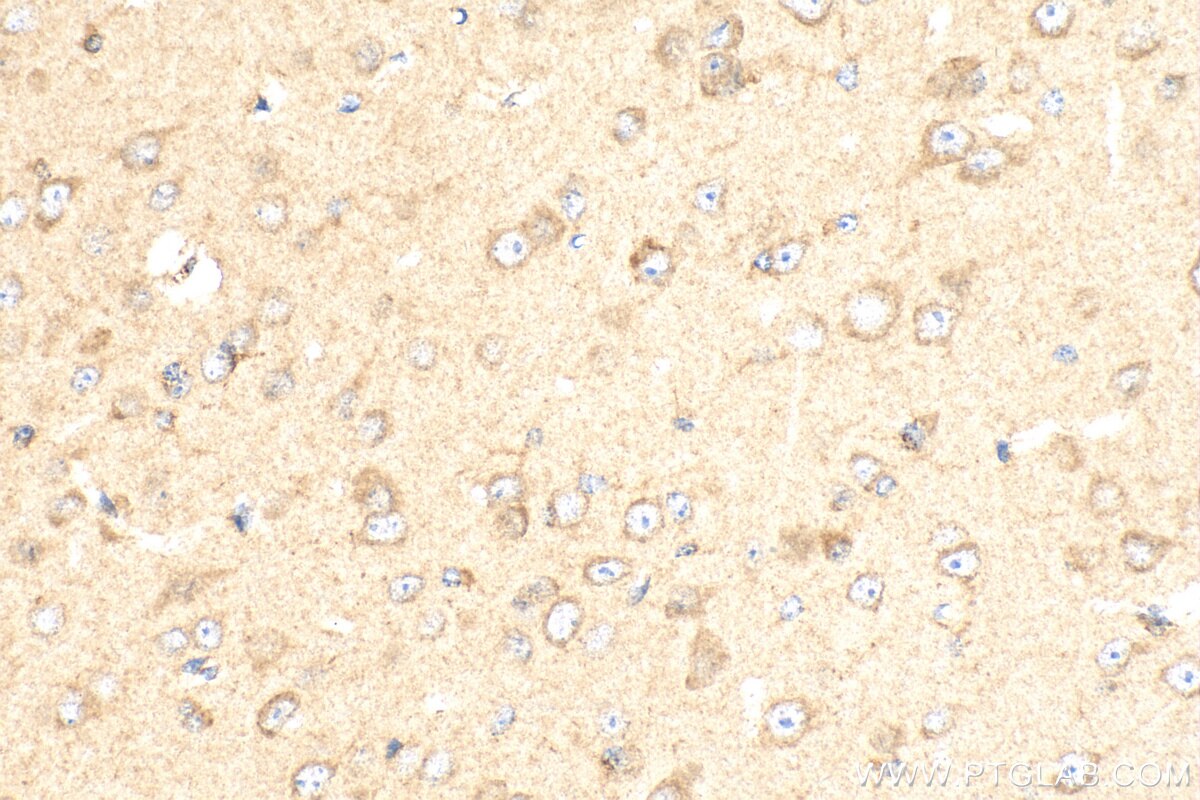 Immunohistochemistry (IHC) staining of mouse brain tissue using HDAC5-specific Polyclonal antibody (16166-1-AP)