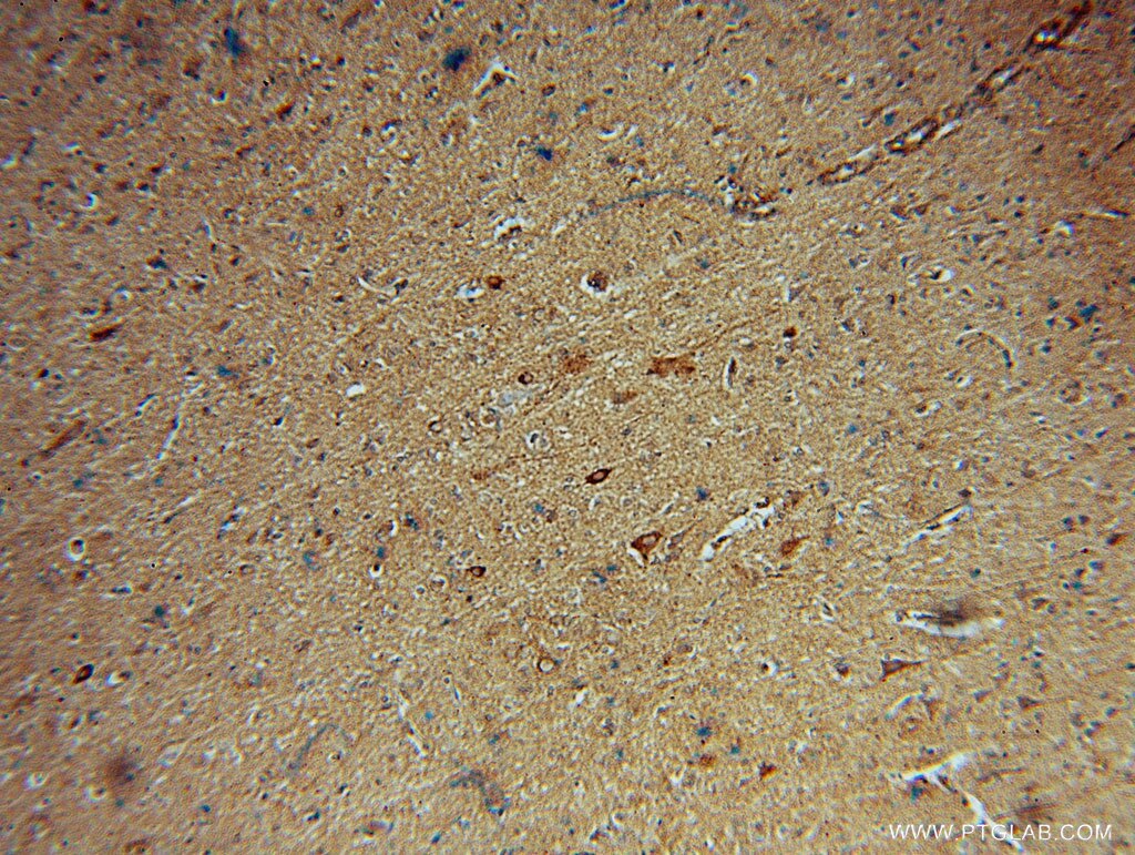 IHC staining of human brain using 16166-1-AP