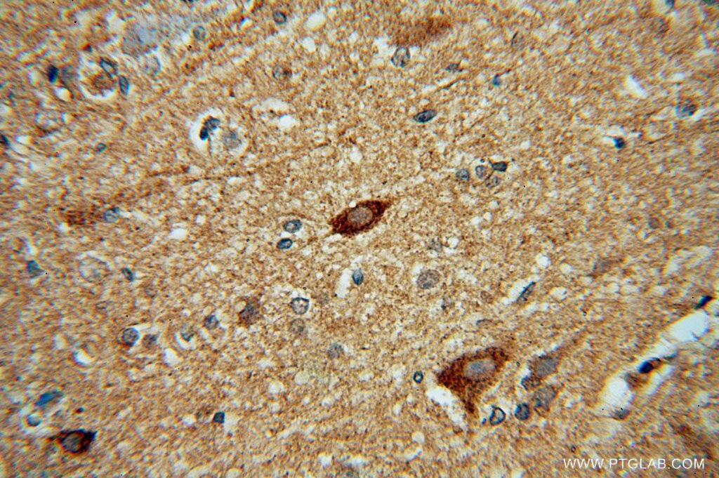 Immunohistochemistry (IHC) staining of human brain tissue using HDAC5-specific Polyclonal antibody (16166-1-AP)