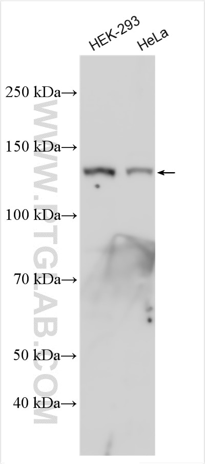 Western Blot (WB) analysis of various lysates using HDAC5-specific Polyclonal antibody (16166-1-AP)