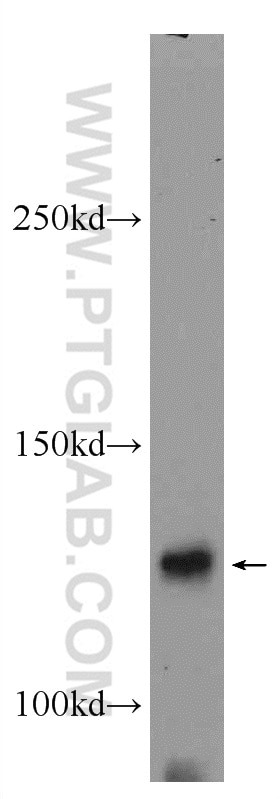 Western Blot (WB) analysis of fetal human brain tissue using HDAC5-specific Polyclonal antibody (16166-1-AP)