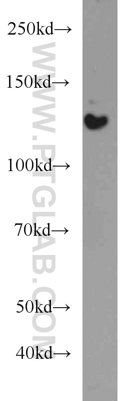 Western Blot (WB) analysis of HeLa cells using HDAC5-specific Polyclonal antibody (16166-1-AP)