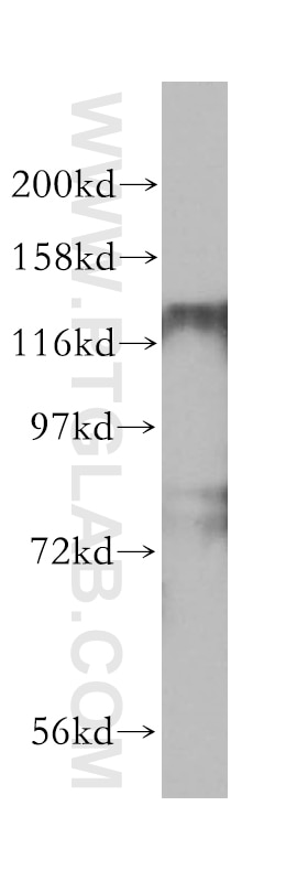 HDAC5-specific Polyclonal antibody