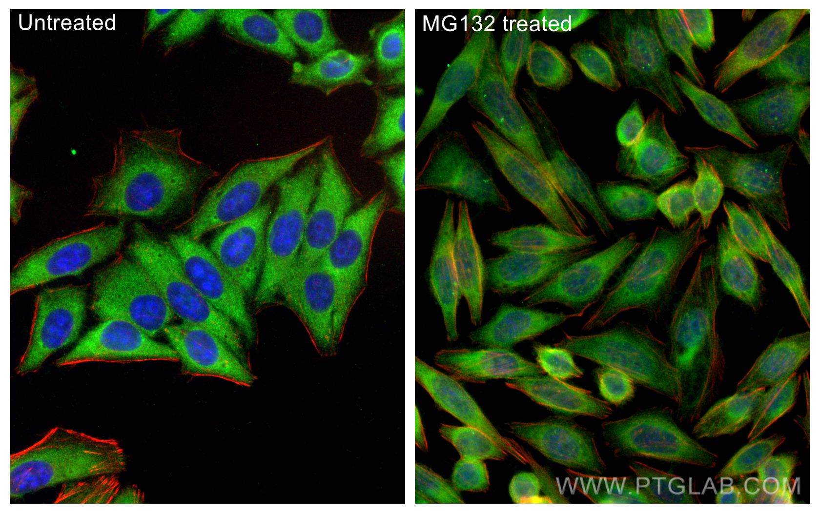 Immunofluorescence (IF) / fluorescent staining of HepG2 cells using HDAC6 Polyclonal antibody (12834-1-AP)