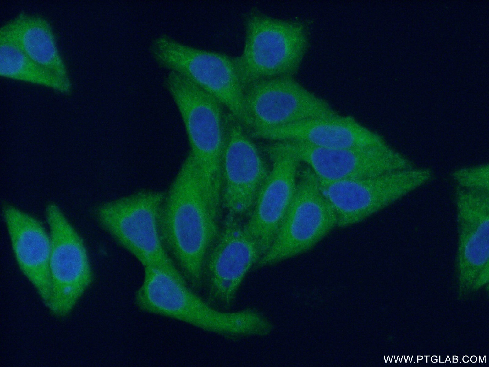 Immunofluorescence (IF) / fluorescent staining of HepG2 cells using HDAC6 Polyclonal antibody (12834-1-AP)