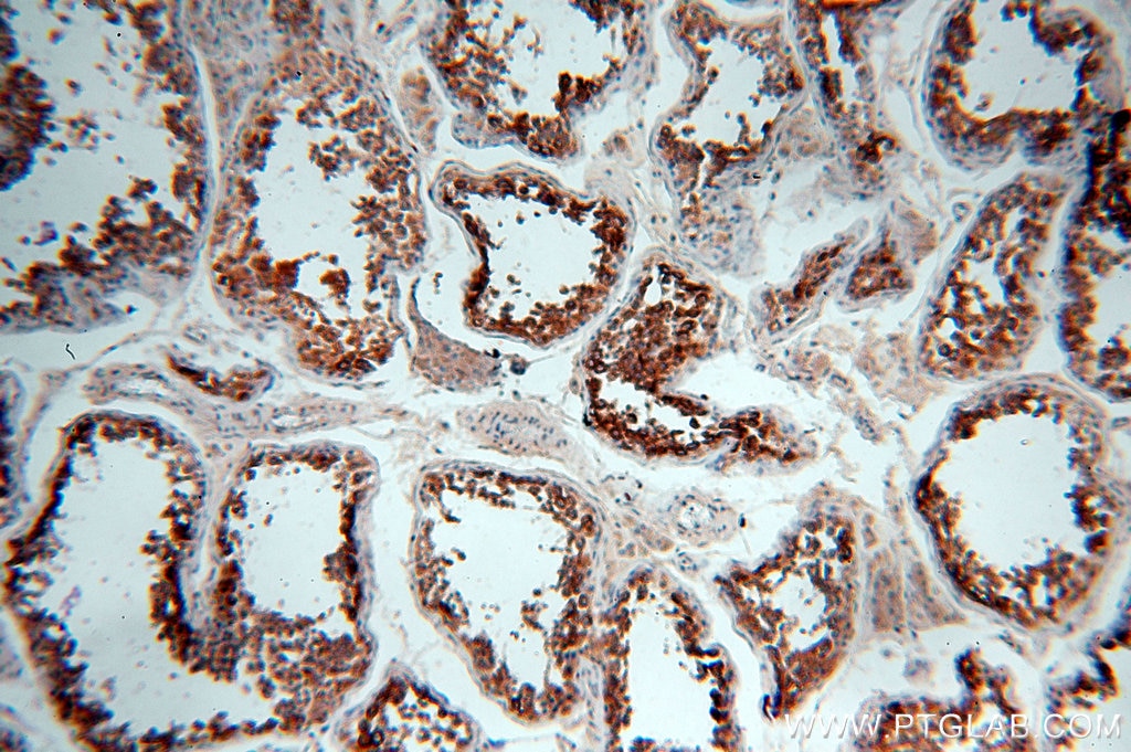 Immunohistochemistry (IHC) staining of human testis tissue using HDAC6 Polyclonal antibody (12834-1-AP)