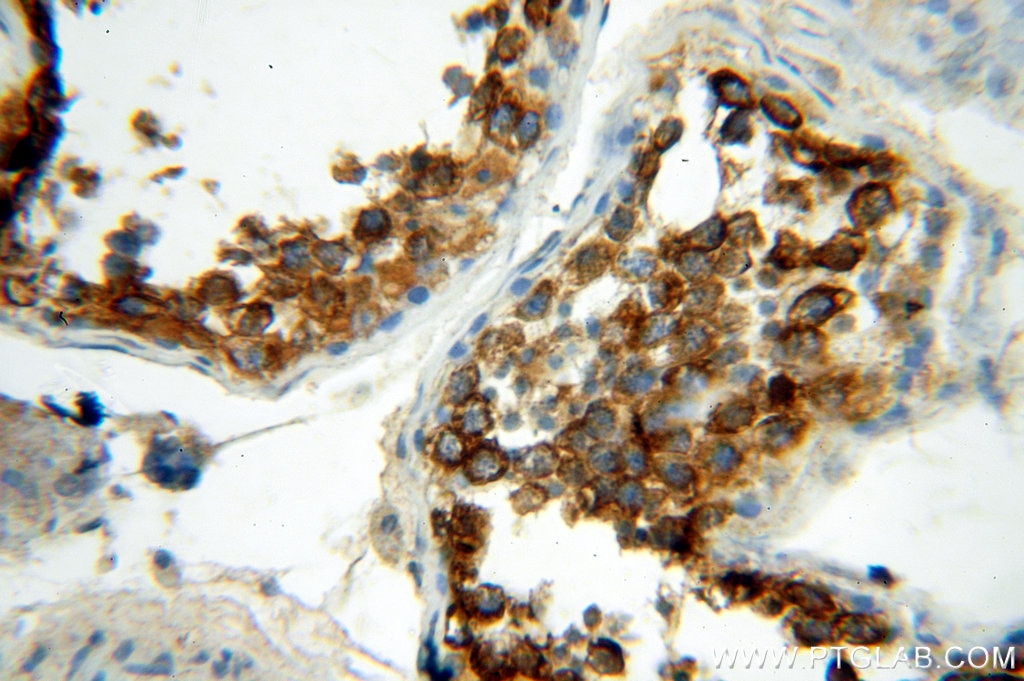 Immunohistochemistry (IHC) staining of human testis tissue using HDAC6 Polyclonal antibody (12834-1-AP)