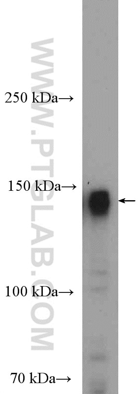 WB analysis of HeLa using 12834-1-AP