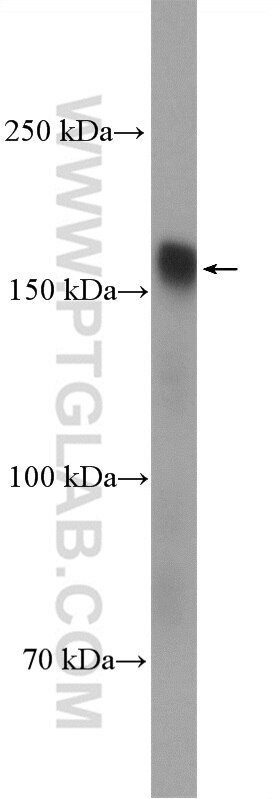 Western Blot (WB) analysis of HepG2 cells using HDAC6 Polyclonal antibody (12834-1-AP)