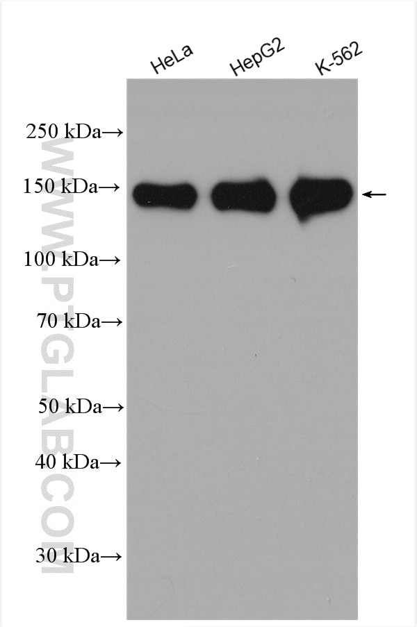 Western Blot (WB) analysis of various lysates using HDAC6 Polyclonal antibody (12834-1-AP)