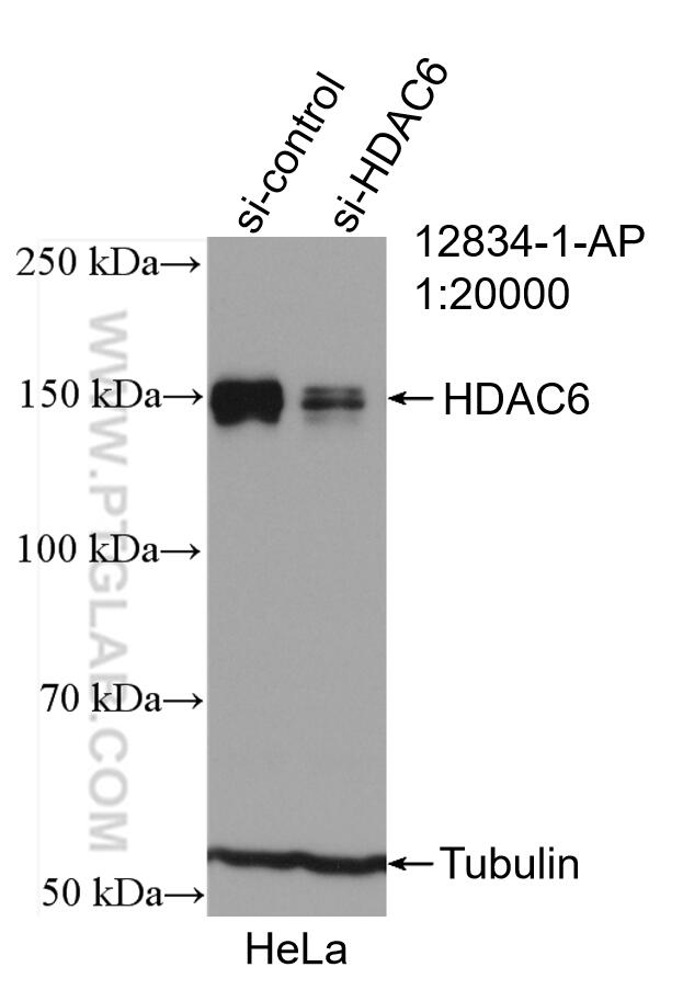 Western Blot (WB) analysis of HeLa cells using HDAC6 Polyclonal antibody (12834-1-AP)