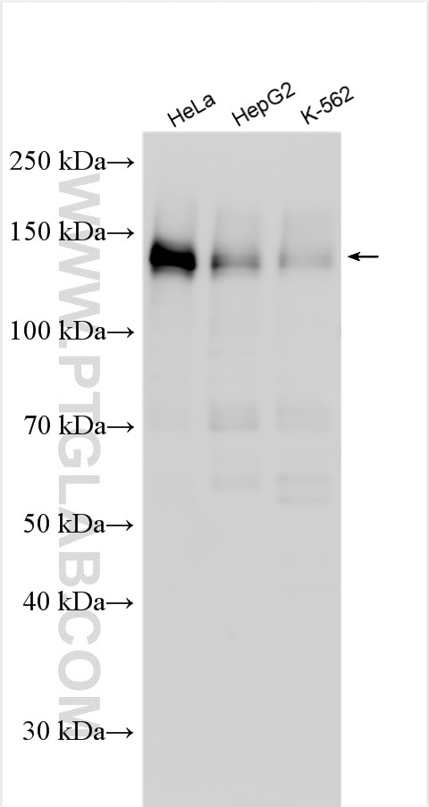 Western Blot (WB) analysis of various lysates using HDAC6 Polyclonal antibody (12834-1-AP)