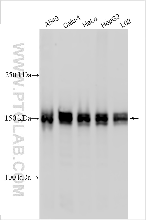 Western Blot (WB) analysis of various lysates using HDAC6 Polyclonal antibody (12834-1-AP)