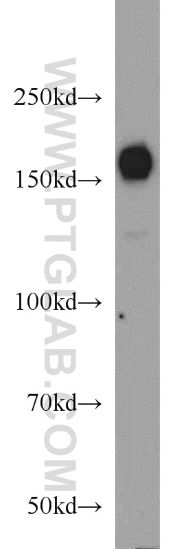 Western Blot (WB) analysis of K-562 cells using HDAC6 Polyclonal antibody (12834-1-AP)