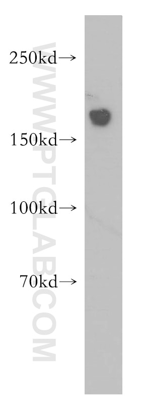 Western Blot (WB) analysis of human liver tissue using HDAC6 Polyclonal antibody (12834-1-AP)