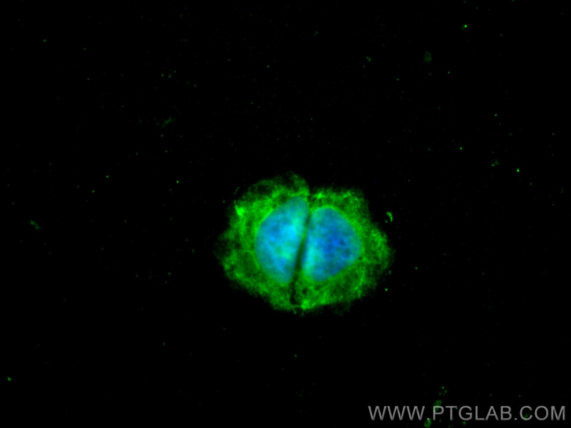 Immunofluorescence (IF) / fluorescent staining of SH-SY5Y cells using HDAC6 Monoclonal antibody (67250-1-Ig)