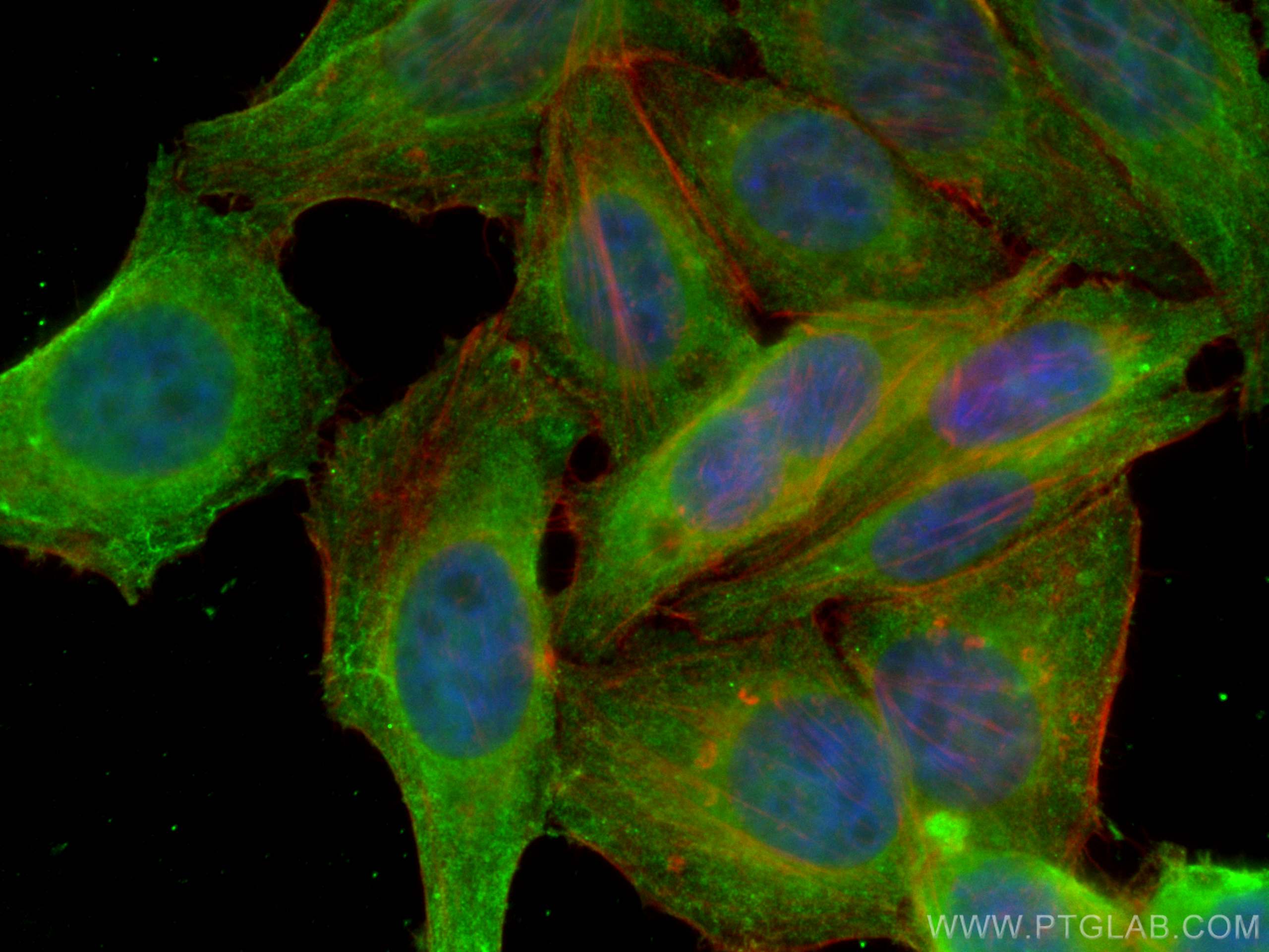 Immunofluorescence (IF) / fluorescent staining of HepG2 cells using HDAC6 Monoclonal antibody (67250-1-Ig)