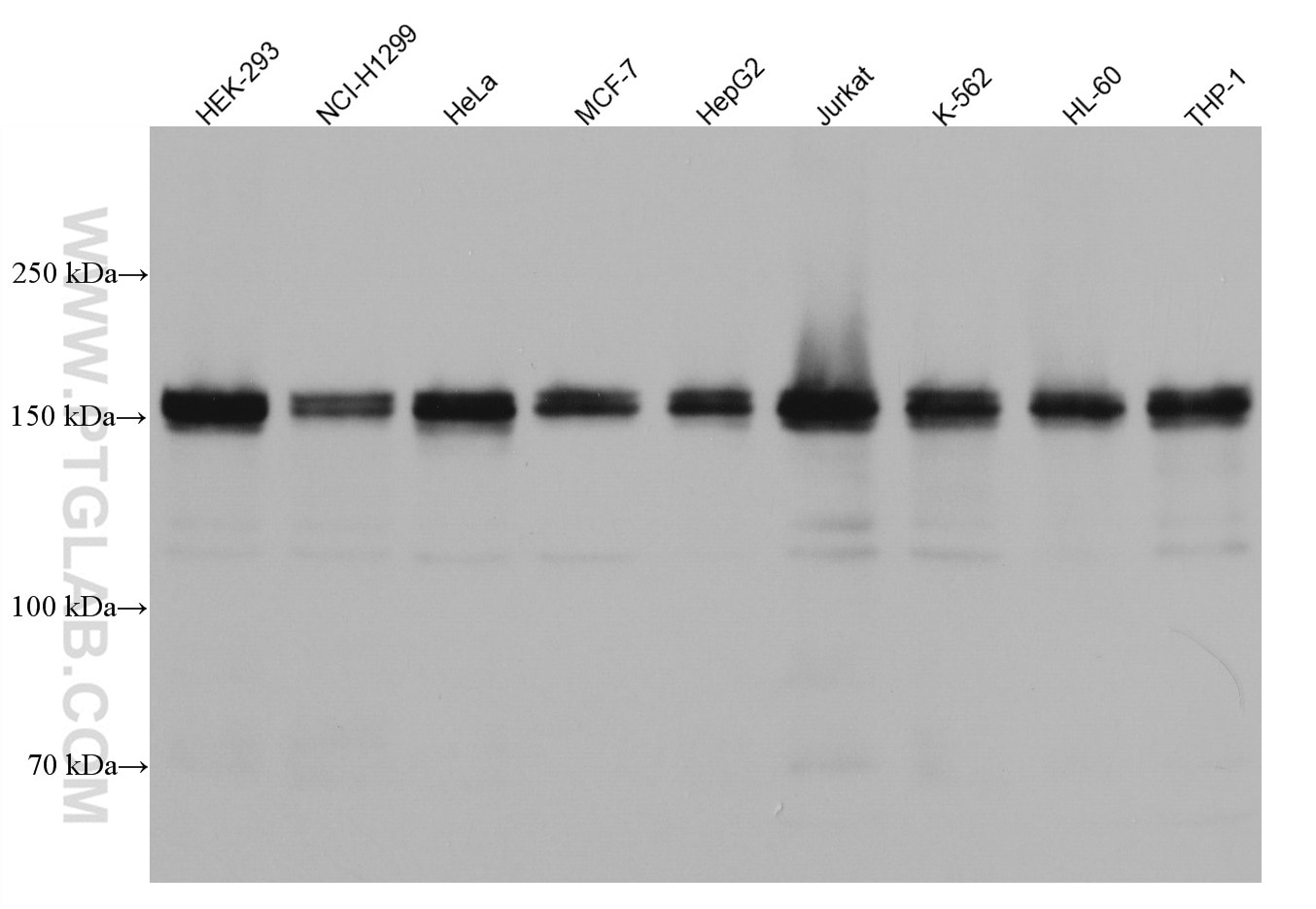 Western Blot (WB) analysis of various lysates using HDAC6 Monoclonal antibody (67250-1-Ig)