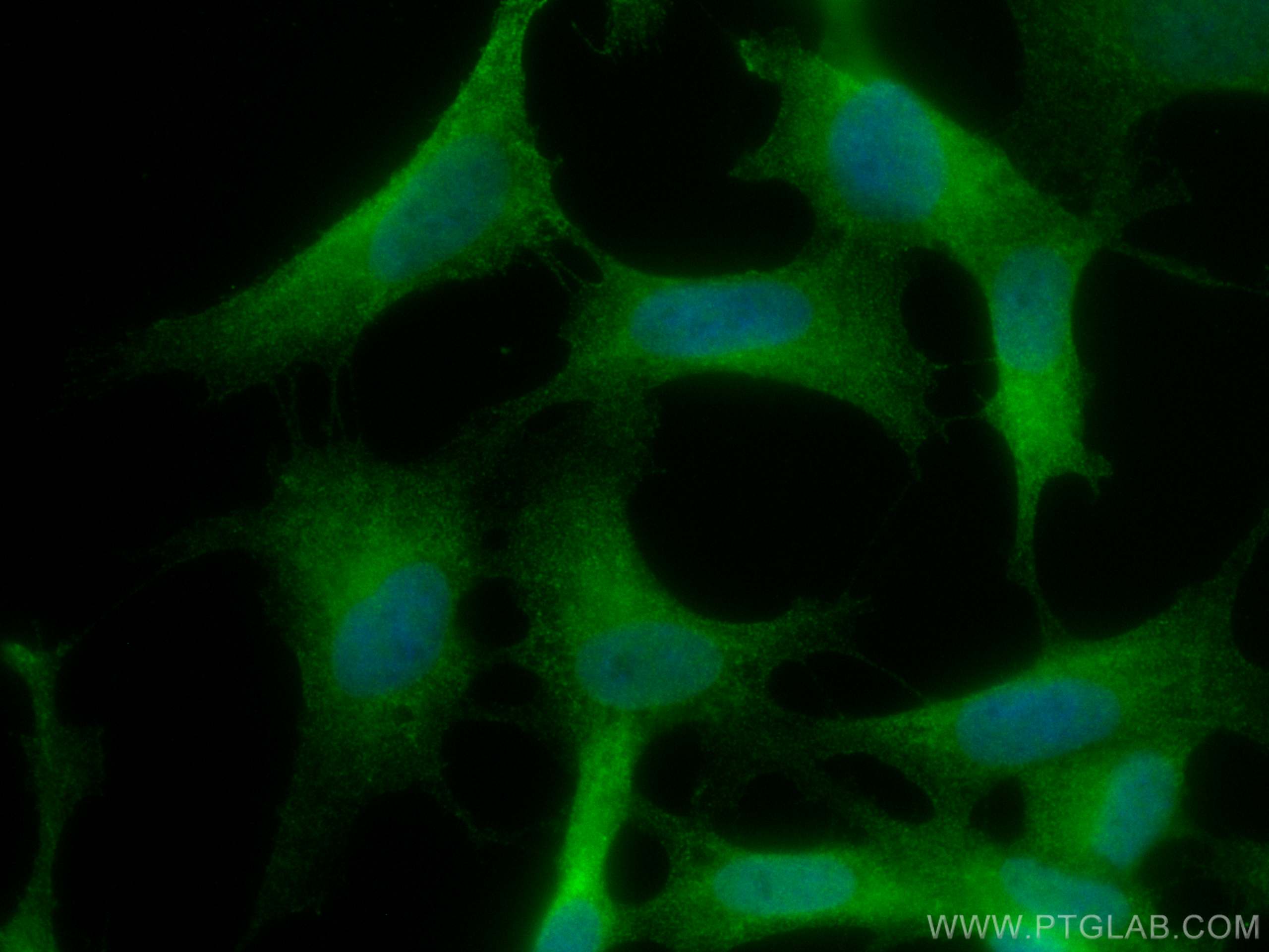 Immunofluorescence (IF) / fluorescent staining of SH-SY5Y cells using CoraLite® Plus 488-conjugated HDAC6 Monoclonal ant (CL488-67250)