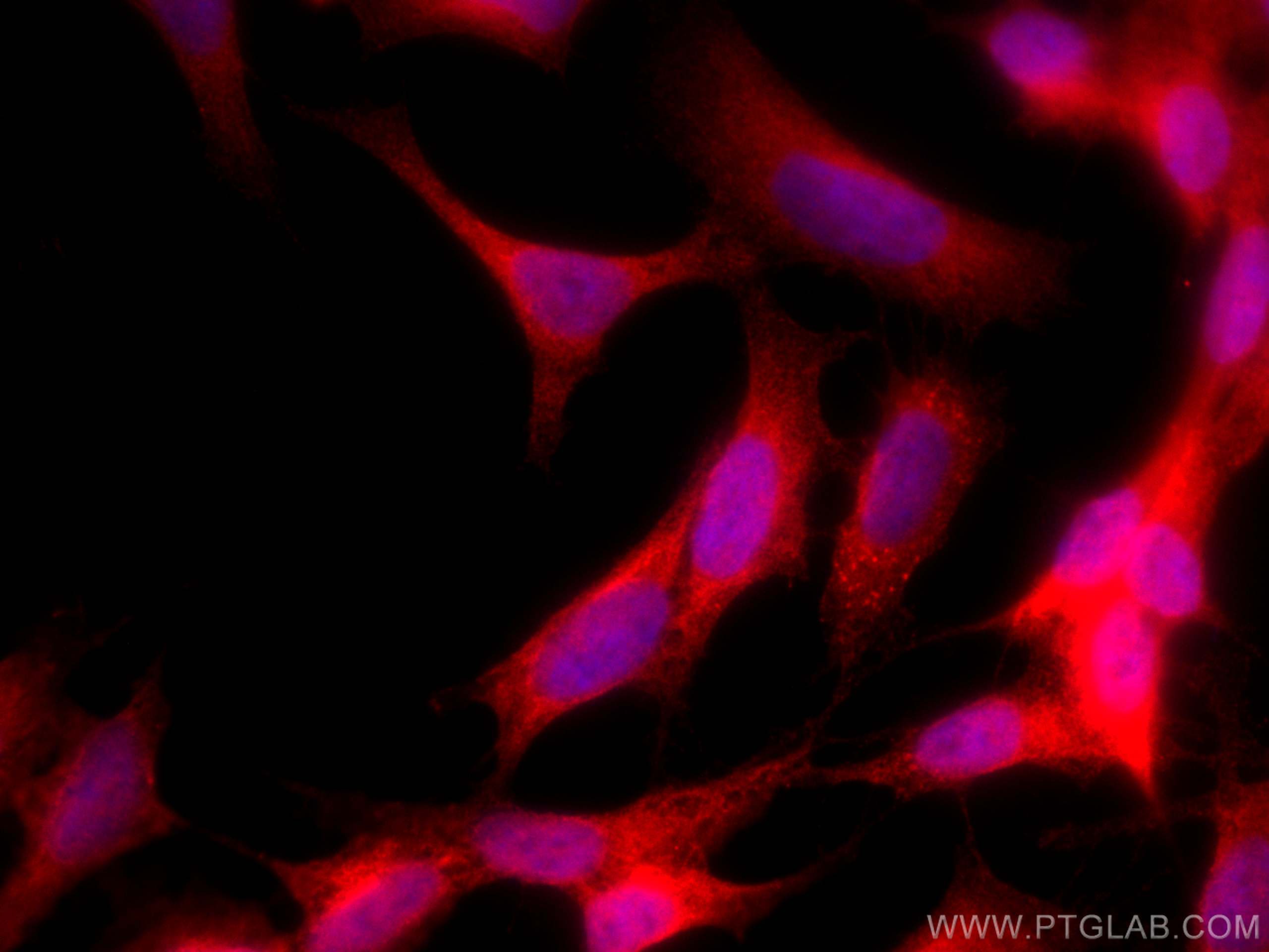 Immunofluorescence (IF) / fluorescent staining of SH-SY5Y cells using CoraLite®594-conjugated HDAC6 Monoclonal antibody (CL594-67250)