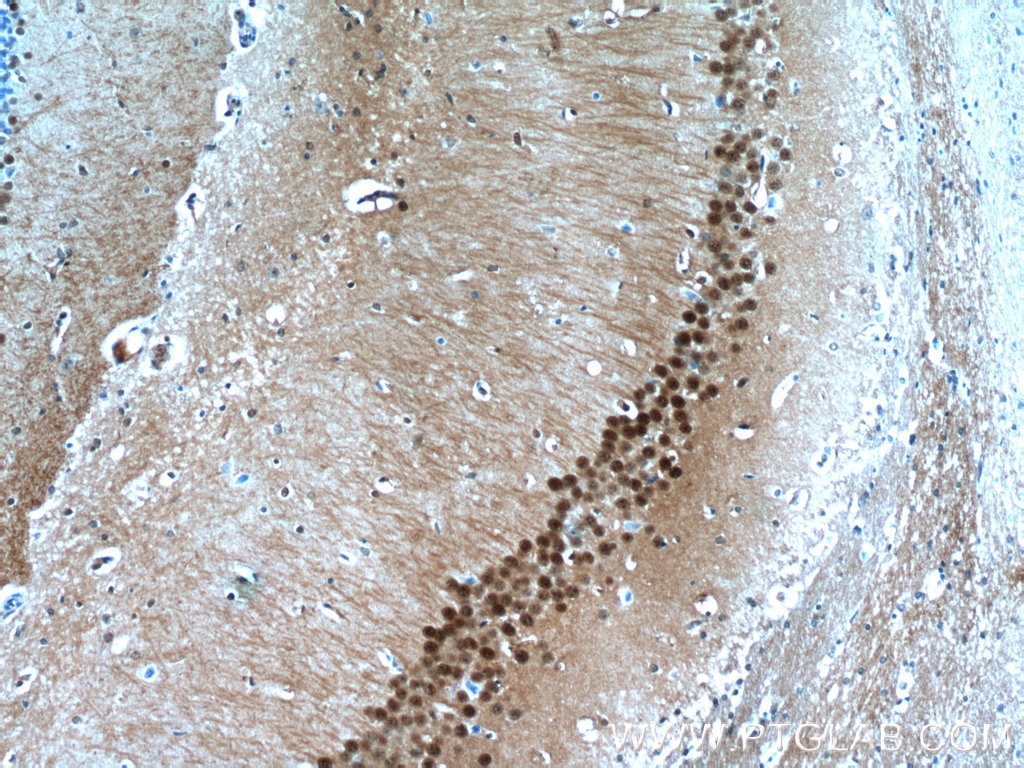 Immunohistochemistry (IHC) staining of mouse brain tissue using HDAC6-specific Polyclonal antibody (16167-1-AP)