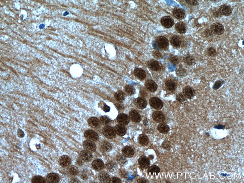 Immunohistochemistry (IHC) staining of mouse brain tissue using HDAC6-specific Polyclonal antibody (16167-1-AP)