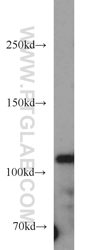 Western Blot (WB) analysis of HT-1080 cells using HDAC6-specific Polyclonal antibody (16167-1-AP)