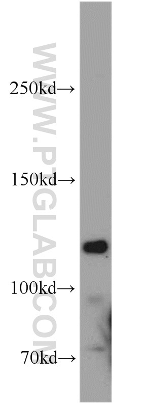Western Blot (WB) analysis of HT-1080 cells using HDAC6-specific Polyclonal antibody (16167-1-AP)