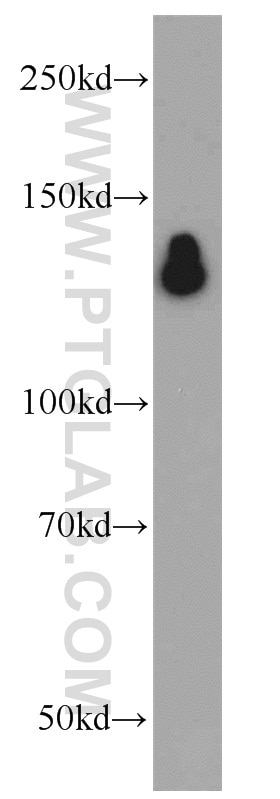 Western Blot (WB) analysis of MCF-7 cells using HDAC6-specific Polyclonal antibody (16167-1-AP)
