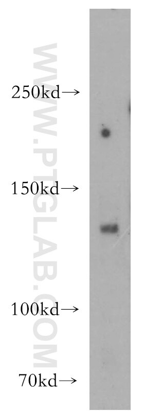 Western Blot (WB) analysis of MCF-7 cells using HDAC6-specific Polyclonal antibody (16167-1-AP)