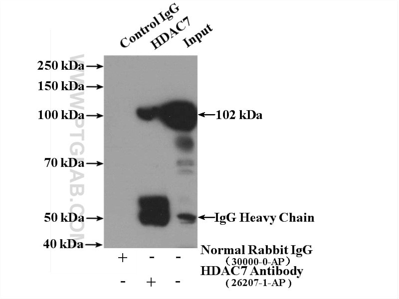 Immunoprecipitation (IP) experiment of K-562 cells using HDAC7 Polyclonal antibody (26207-1-AP)