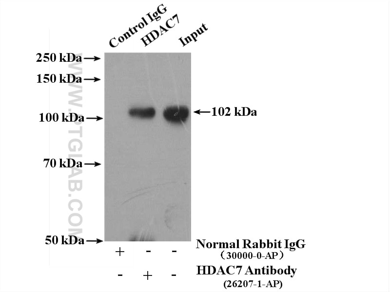 Immunoprecipitation (IP) experiment of K-562 cells using HDAC7 Polyclonal antibody (26207-1-AP)