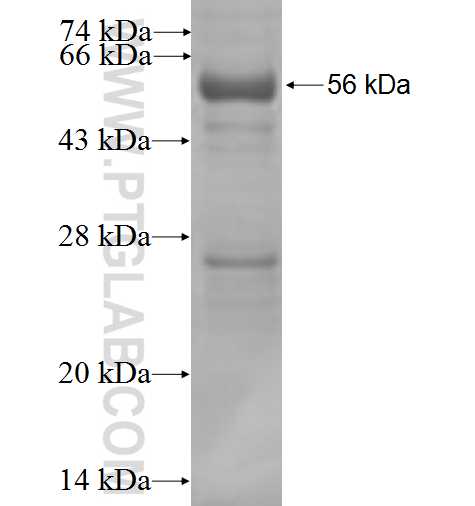 HDAC7 fusion protein Ag1101 SDS-PAGE